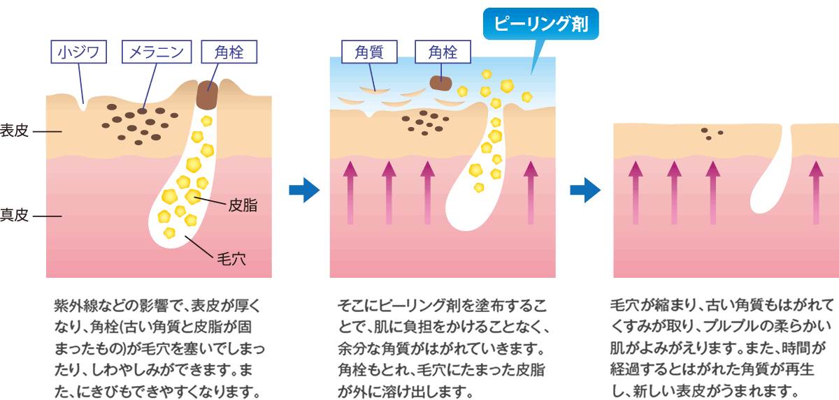 美容皮膚科|CHARIS BEAUTY CLINIC - カリスビューティクリニック 大阪